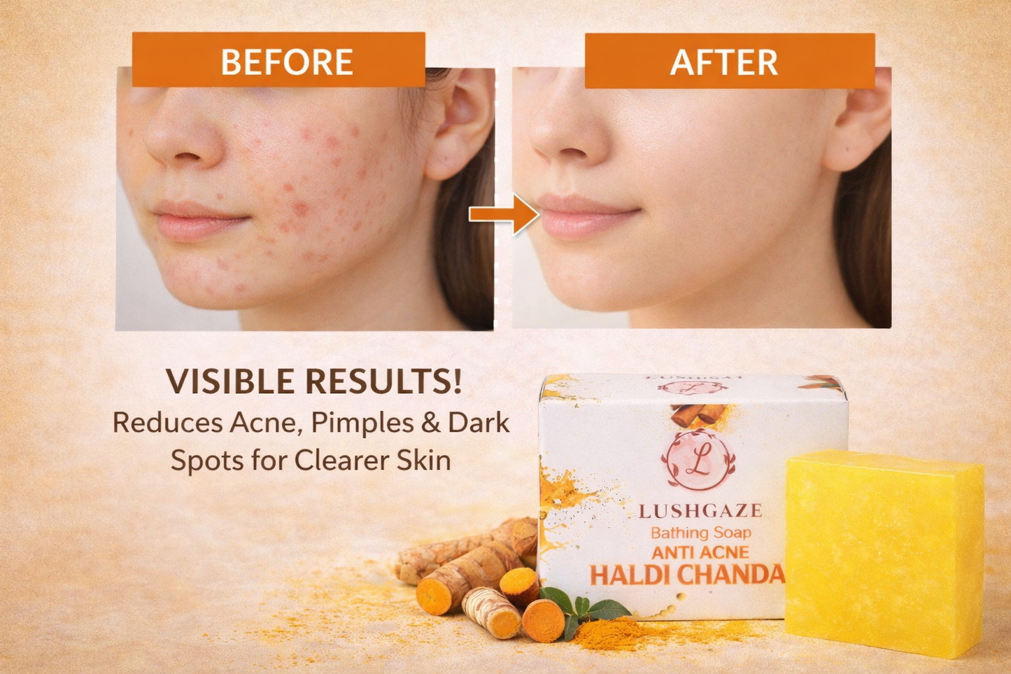 BATHING SOAP ANTI ACNE HALDI CHANDAN
